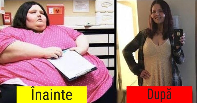 17 persoane care și-au arătat fotografiile de înainte și după pierderea în greutate , rezultatele sunt uimitoare