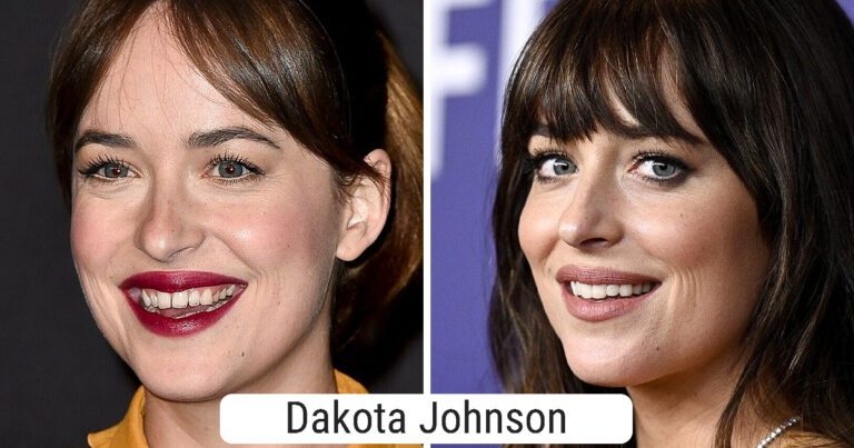 15 celebrități care și-au schimbat dinții și acum pot uimi pe toată lumea cu zâmbetul lor perfect
